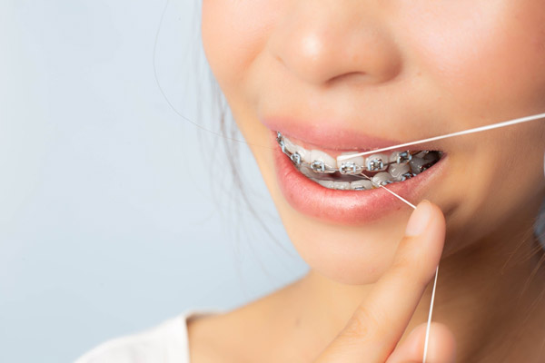 Three Cosmetic Orthodontic Options To Improve Your Smile