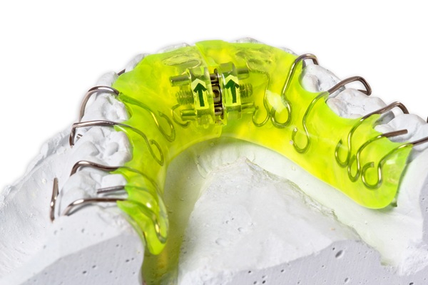 What To Do When Retainers Break